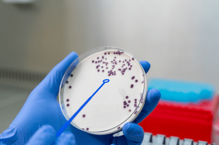 Petri Dish