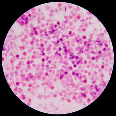 Gram Stain