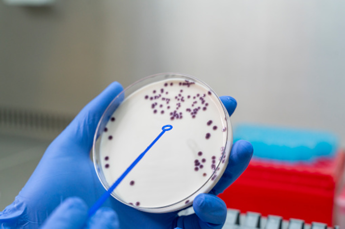 Petri Dish